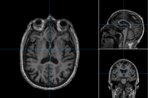 Highlights Anatomical details, lesions, tumors