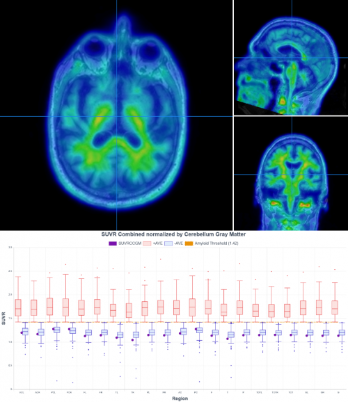 Normal Patient determined Negative